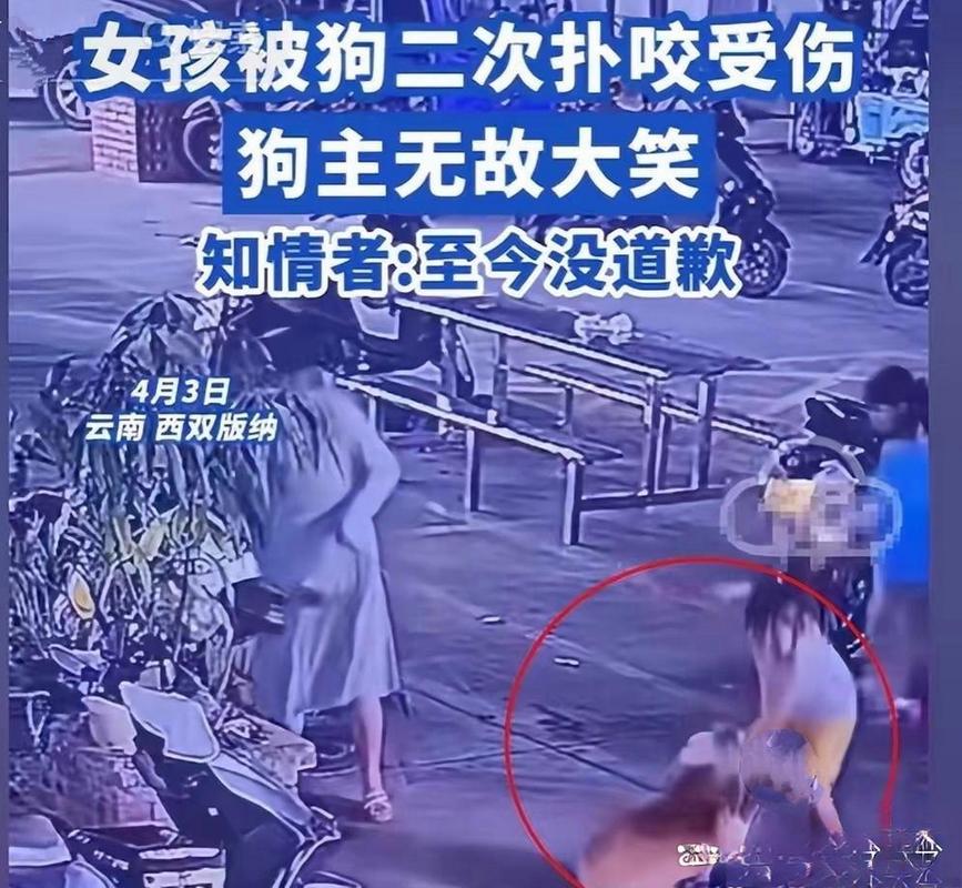 女童被狗扑咬受伤,女儿被小狗咬了没出血怎么办